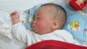 Những biểu hiện lâm sàng của bệnh sởi
