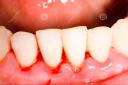 10 bệnh răng miệng phổ biến nhất, nguyên nhân và hướng điều trị.